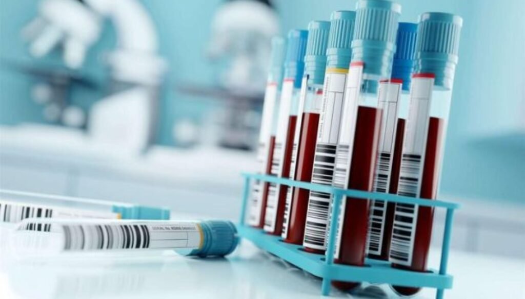 Blood_Tests_resized_50_percent